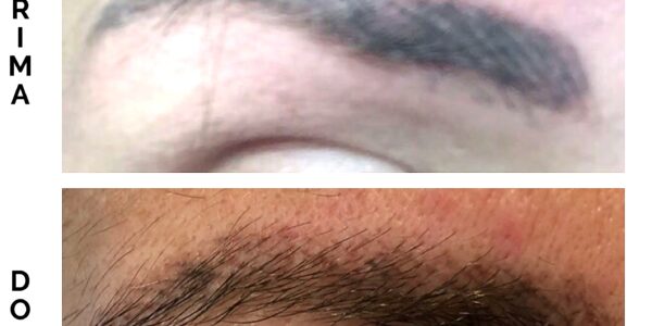 Dopo 1 sola seduta , Microblading sopracciglia